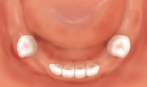 2歳児のお口-下顎